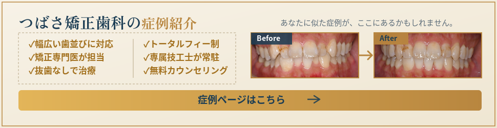 つばさ矯正歯科の症例紹介