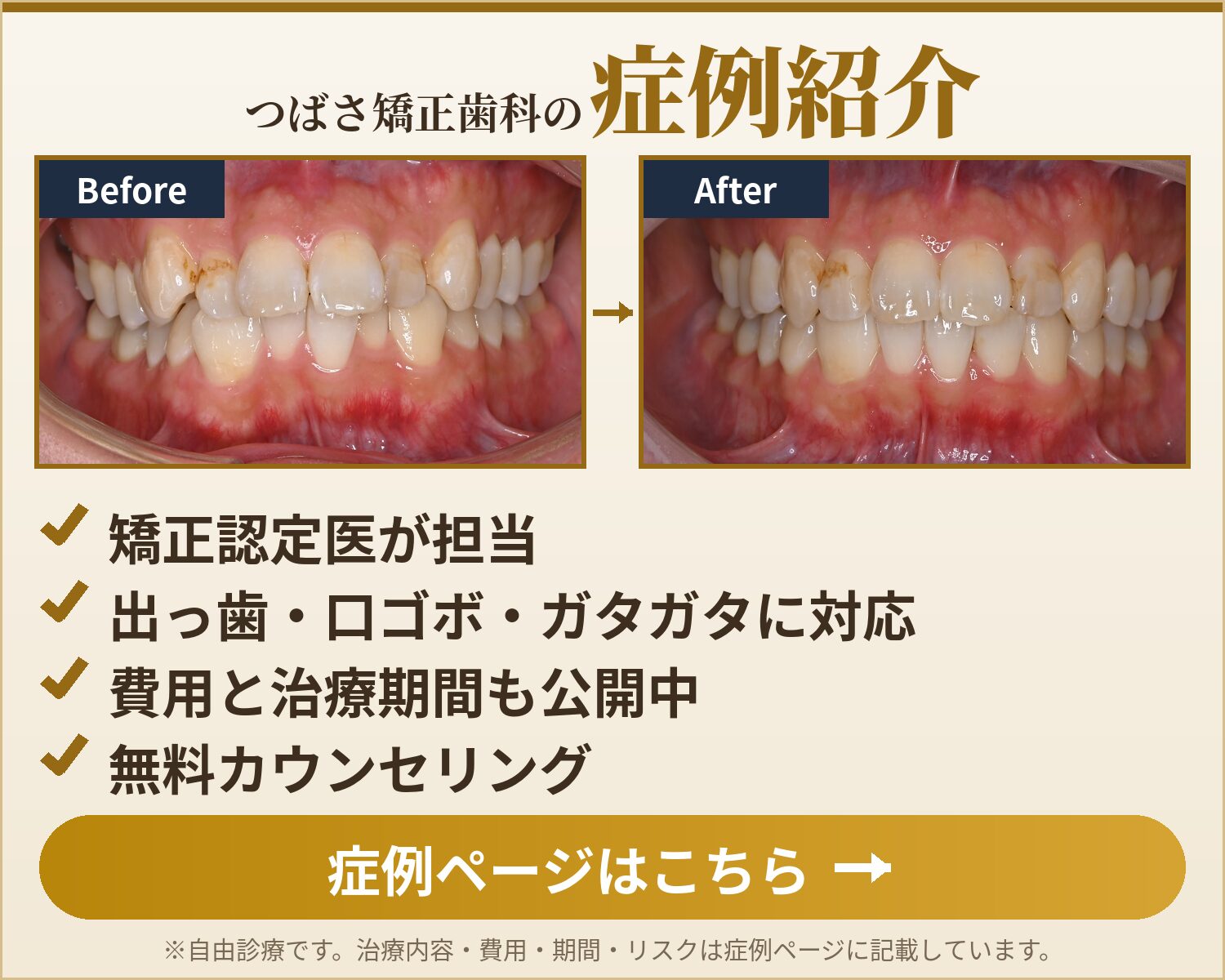 つばさ矯正歯科の症例紹介　症例ページはこちら