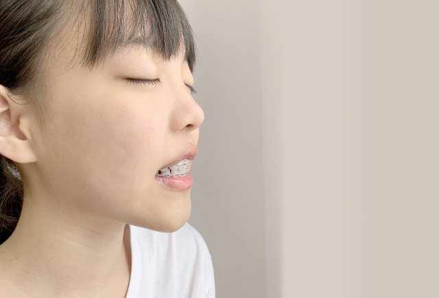 矯正中の見た目にあまりこだわらない方